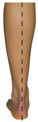 Neutral Pronation